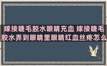 嫁接睫毛胶水眼睛充血 嫁接睫毛胶水弄到眼睛里眼睛红血丝疼怎么回事